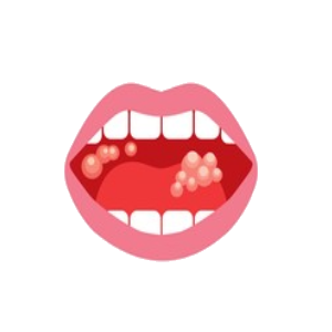 blog-01